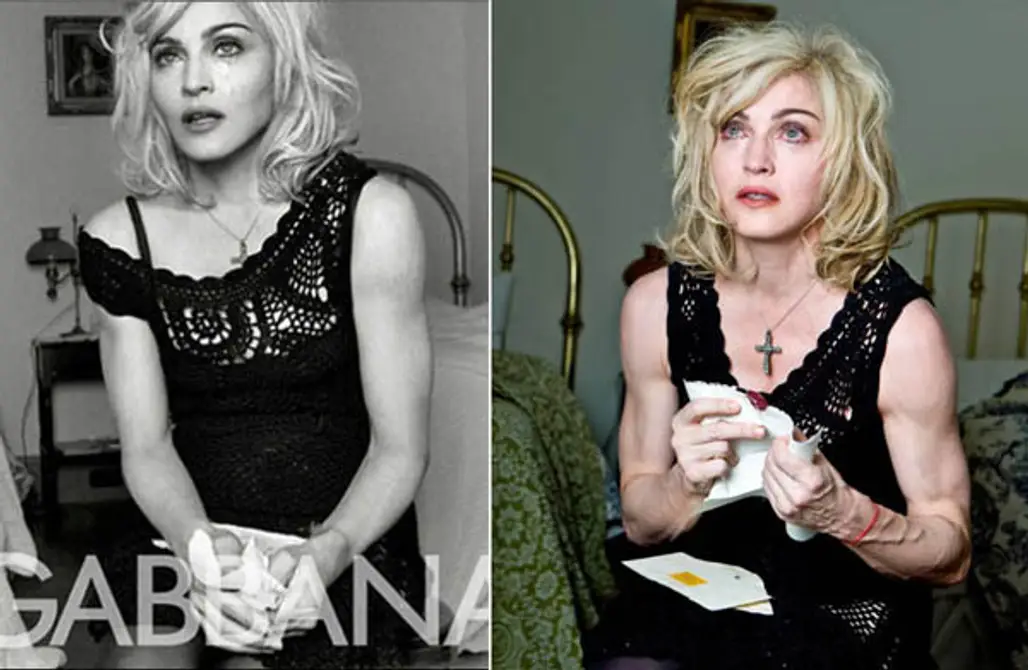 Madonna = Signs of Aging