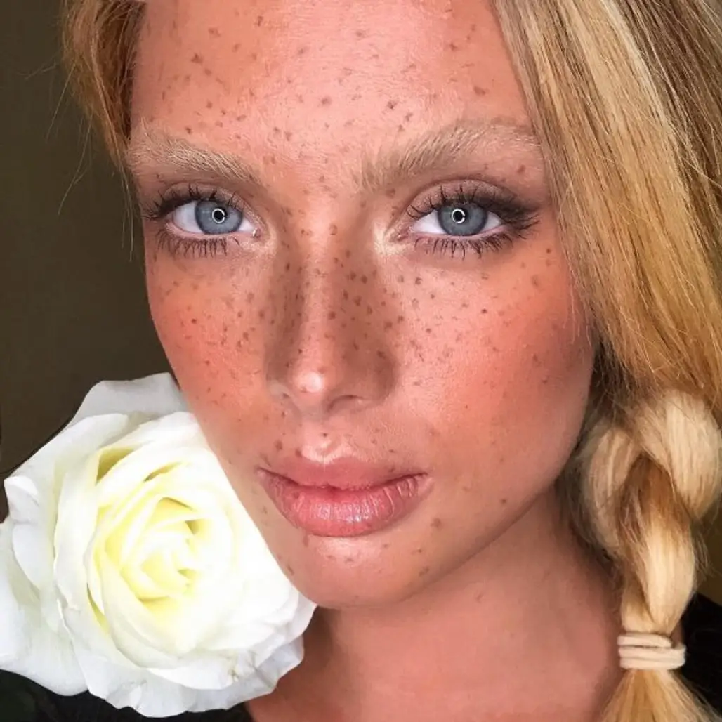 Nikki's Freckles