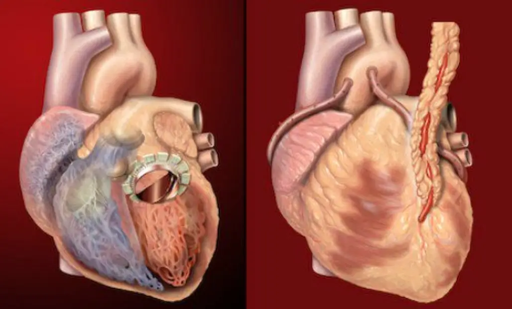 Did You Know Your Heart Beats 101,000 Times a Day?