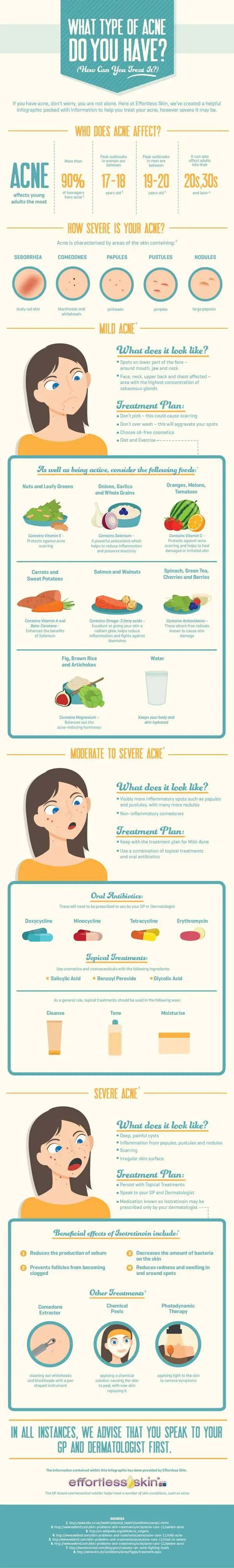 What Type of Acne do You Have?